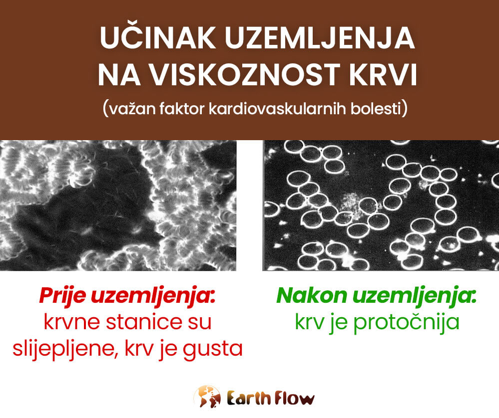 Učinak uzemljenja na viskoznost krvi - Earth Flow