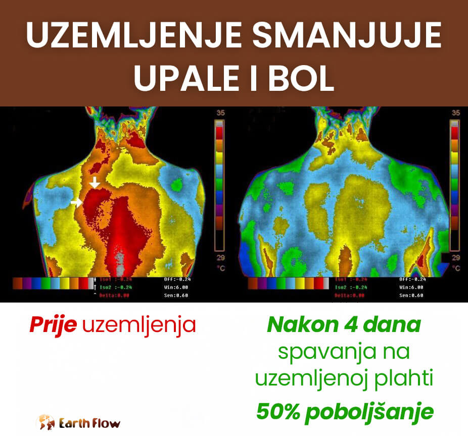 Uzemljenje smanjuje upale i bolove - Earth Flow