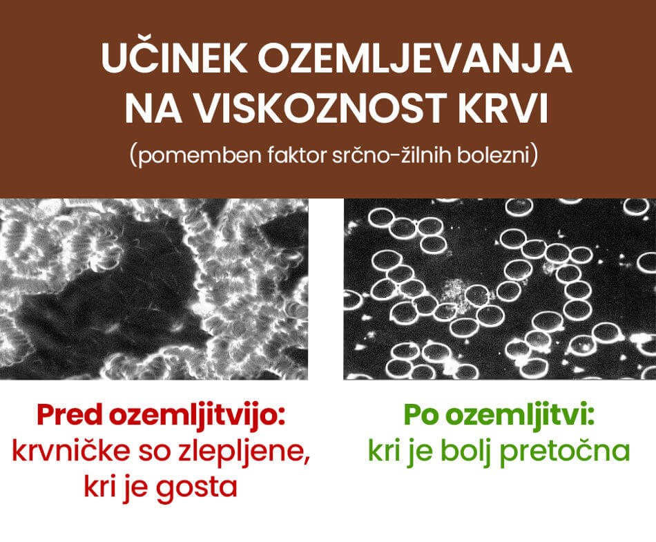 Boljša pretočnost krvi - ozemljitvena podloga Earth Flow