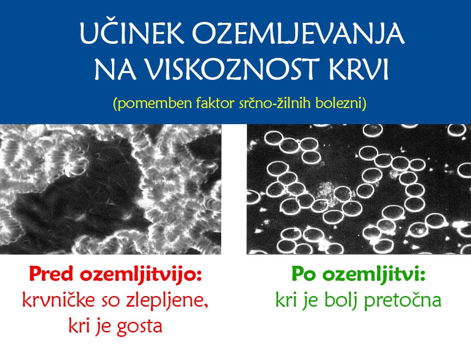Boljša pretočnost krvi - ozemljitvena podloga Earth Flow