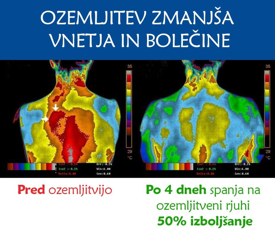 Manjša vnetja - ozemljitvena podloga Earth Flow