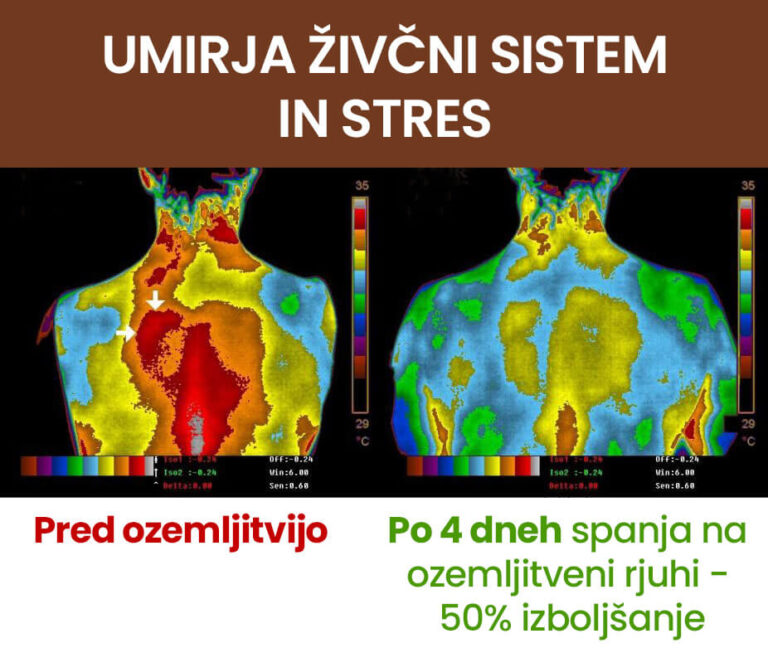 Zmanjša vnetja3_51-2